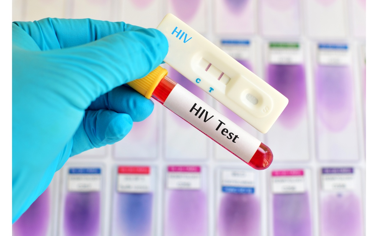 Empower Yourself with HIV Treatment Options: Take Control of Your Health